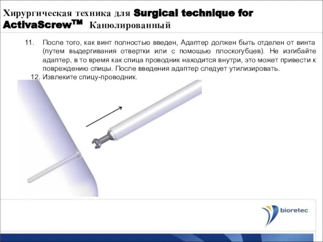 Хирургическая техника для Surgical technique for ActivaScrewTM Канюлированный После того, как винт
