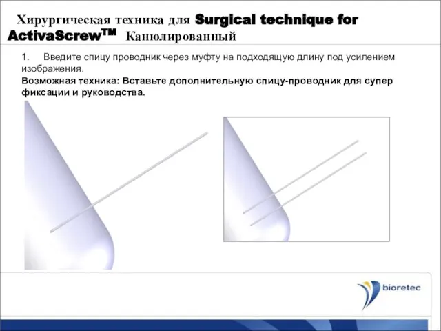 Хирургическая техника для Surgical technique for ActivaScrewTM Канюлированный 1. Введите спицу проводник