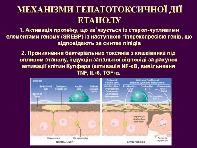 МЕХАНІЗМИ ГЕПАТОТОКСИЧНОЇ ДІЇ ЕТАНОЛУ 1. Активація протеїну, що зв`язується із стерол-чутливими елементами