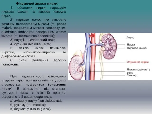 Фіксуючий апарат нирки: 1) оболонки нирки, передусім ниркова фасція та жирова капсула