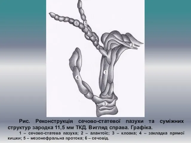 Рис. Реконструкція сечово-статевої пазухи та суміжних структур зародка 11,5 мм ТКД. Вигляд