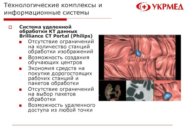 Технологические комплексы и информационные системы Система удаленной обработки КТ данных Brilliance CT