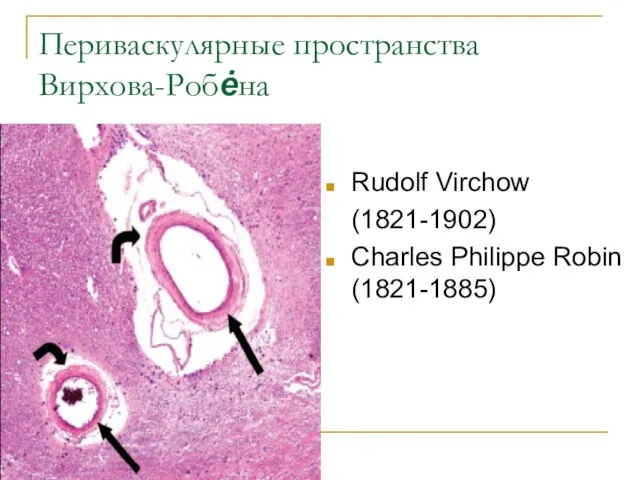 Периваскулярные пространства Вирхова-Робėна Rudolf Virchow (1821-1902) Charles Philippe Robin (1821-1885)