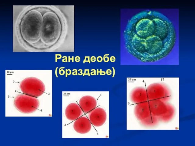 Ране деобе (браздање)