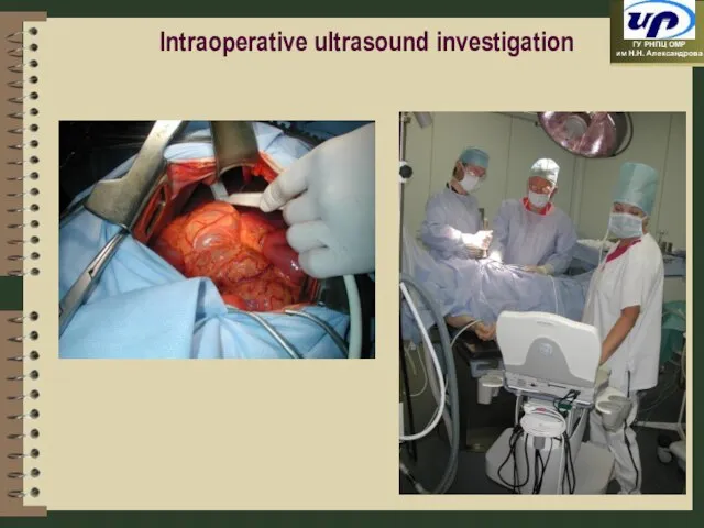 Intraoperative ultrasound investigation