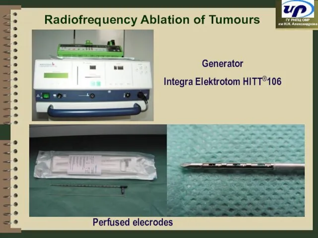 Radiofrequency Ablation of Tumours Perfused elecrodes Generator Integra Elektrotom HITT®106