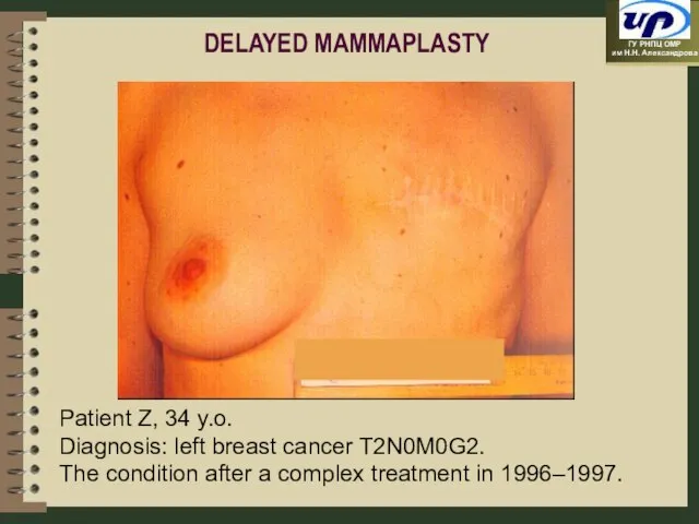 Patient Z, 34 y.o. Diagnosis: left breast cancer T2N0M0G2. The condition after