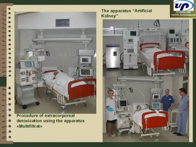 The apparatus “Artificial Kidney” Procedure of extracorporeal detoxication using the apparatus «Multifiltrat»