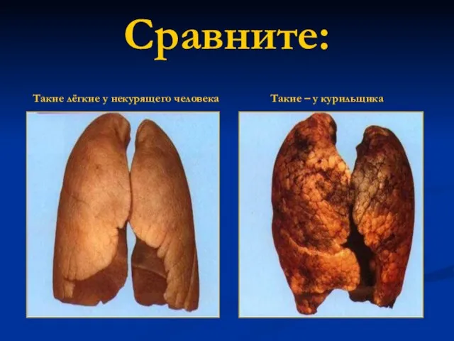 Сравните: Такие лёгкие у некурящего человека Такие – у курильщика