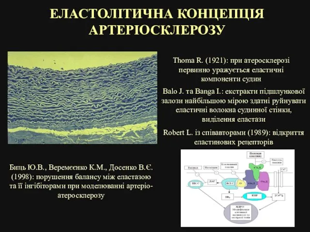 ЕЛАСТОЛІТИЧНА КОНЦЕПЦІЯ АРТЕРІОСКЛЕРОЗУ Thoma R. (1921): при атеросклерозі первинно уражується еластичні компоненти