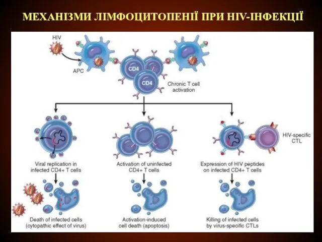 МЕХАНІЗМИ ЛІМФОЦИТОПЕНІЇ ПРИ HIV-ІНФЕКЦІЇ