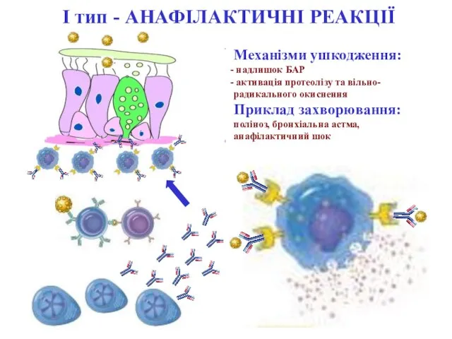 І тип - АНАФІЛАКТИЧНІ РЕАКЦІЇ Механізми ушкодження: надлишок БАР активація протеолізу та