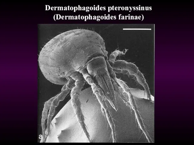 Dermatophagoides pteronyssinus (Dermatophagoides farinae)