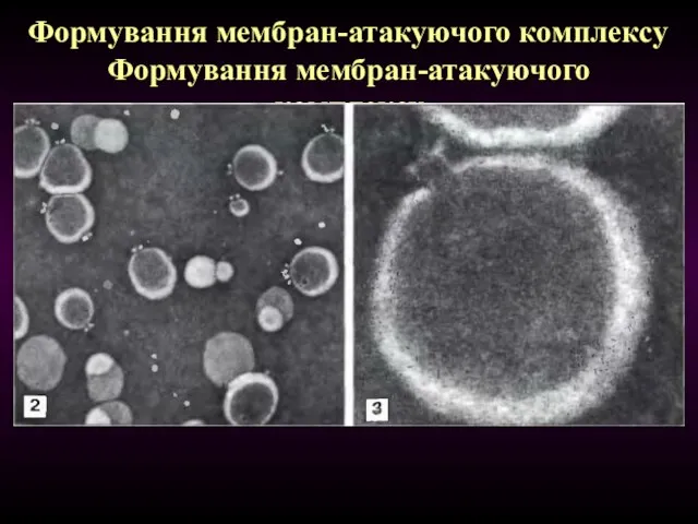 Формування мембран-атакуючого комплексу Формування мембран-атакуючого комплексу