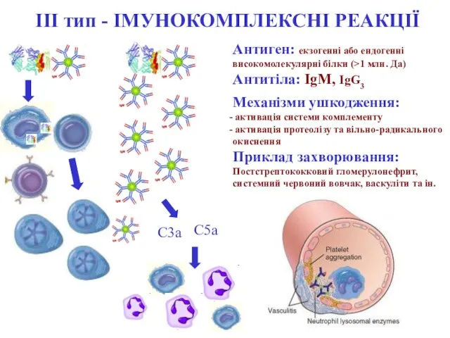 Механізми ушкодження: активація системи комплементу активація протеолізу та вільно-радикального окиснення Приклад захворювання: