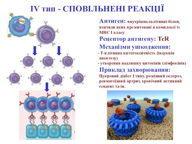 Механізми ушкодження: Т-клітинна цитотоксичність (індукція апоптозу) утворення надлишку цитокінів (лімфокінів) Приклад захворювання: