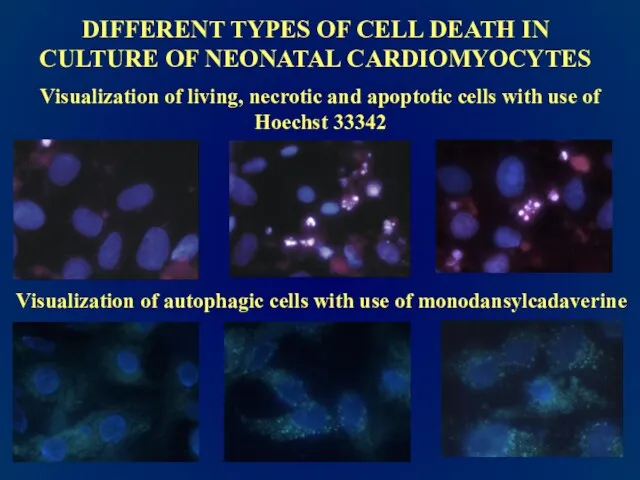 DIFFERENT TYPES OF CELL DEATH IN CULTURE OF NEONATAL CARDIOMYOCYTES Visualization of