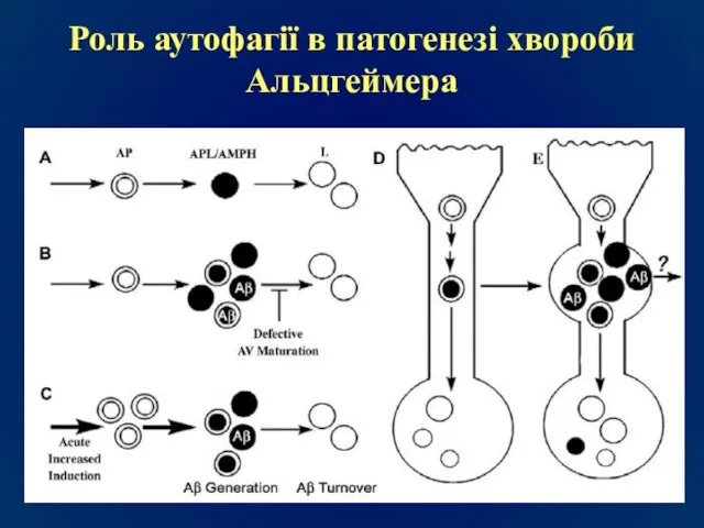 Роль аутофагії в патогенезі хвороби Альцгеймера