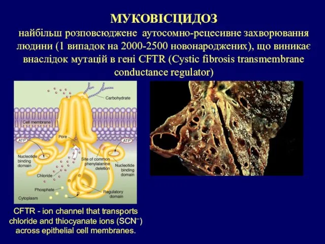 CFTR - ion channel that transports chloride and thiocyanate ions (SCN–) across