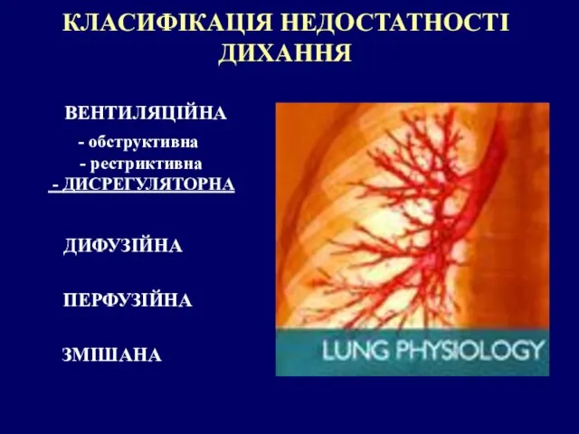 КЛАСИФІКАЦІЯ НЕДОСТАТНОСТІ ДИХАННЯ ВЕНТИЛЯЦІЙНА ПЕРФУЗІЙНА ДИФУЗІЙНА обструктивна - рестриктивна - ДИСРЕГУЛЯТОРНА ЗМІШАНА