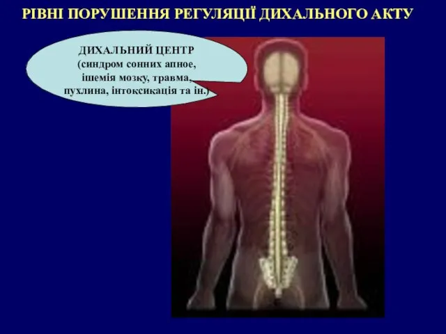 РІВНІ ПОРУШЕННЯ РЕГУЛЯЦІЇ ДИХАЛЬНОГО АКТУ ДИХАЛЬНИЙ ЦЕНТР (синдром сонних апное, ішемія мозку,