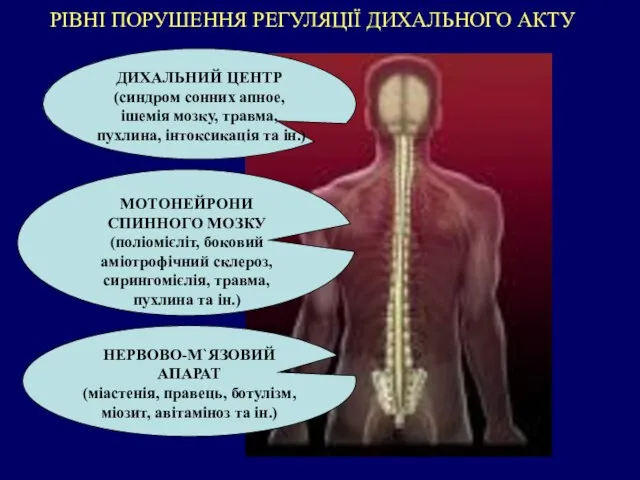 РІВНІ ПОРУШЕННЯ РЕГУЛЯЦІЇ ДИХАЛЬНОГО АКТУ ДИХАЛЬНИЙ ЦЕНТР (синдром сонних апное, ішемія мозку,