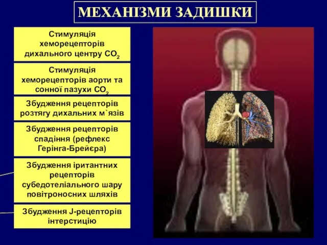 МЕХАНІЗМИ ЗАДИШКИ Стимуляція хеморецепторів дихального центру СО2 Стимуляція хеморецепторів аорти та сонної