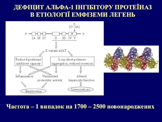 ДЕФІЦИТ АЛЬФА-1 ІНГІБІТОРУ ПРОТЕЇНАЗ В ЕТІОЛОГІЇ ЕМФІЗЕМИ ЛЕГЕНЬ Частота – 1 випадок