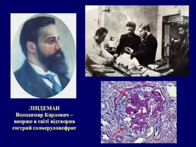 ЛІНДЕМАН Володимир Карлович – вперше в світі відтворив гострий гломерулонефрит