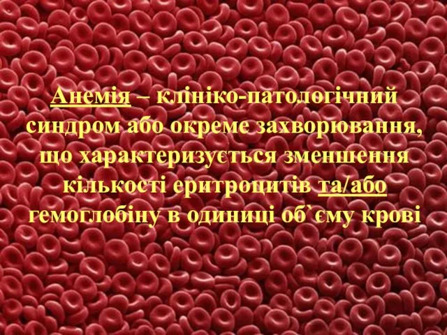 Анемія – клініко-патологічний синдром або окреме захворювання, що характеризується зменшення кількості еритроцитів