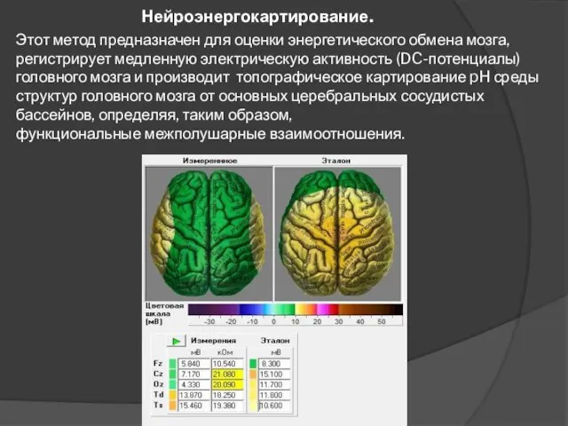 Нейроэнергокартирование. Этот метод предназначен для оценки энергетического обмена мозга, регистрирует медленную электрическую