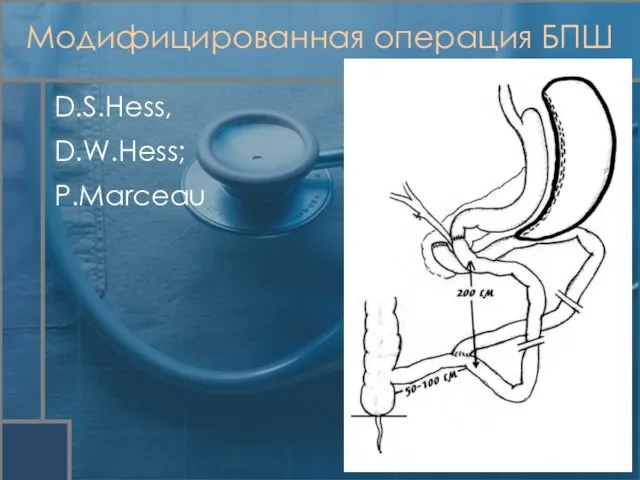 Модифицированная операция БПШ D.S.Hess, D.W.Hess; P.Marceau