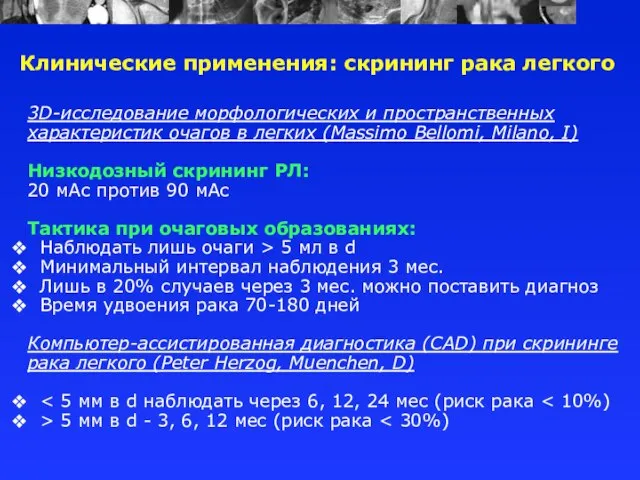 3D-исследование морфологических и пространственных характеристик очагов в легких (Massimo Bellomi, Milano, I)