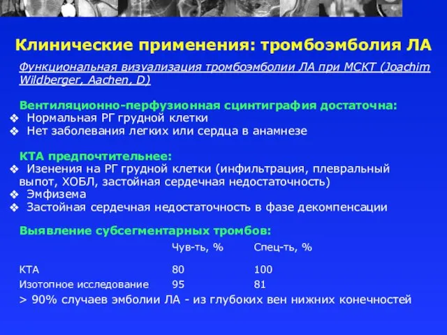 Функциональная визуализация тромбоэмболии ЛА при МСКТ (Joachim Wildberger, Aachen, D) Вентиляционно-перфузионная сцинтиграфия