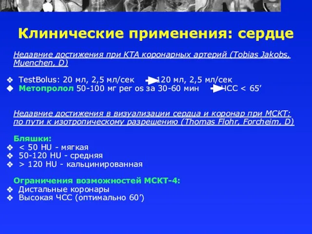 Недавние достижения при КТА коронарных артерий (Tobias Jakobs, Muenchen, D) TestBolus: 20
