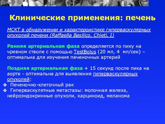 МСКТ в обнаружении и характероистике гиперваскулярных опухолей печени (Raffaella Basilico, Chieti, I)