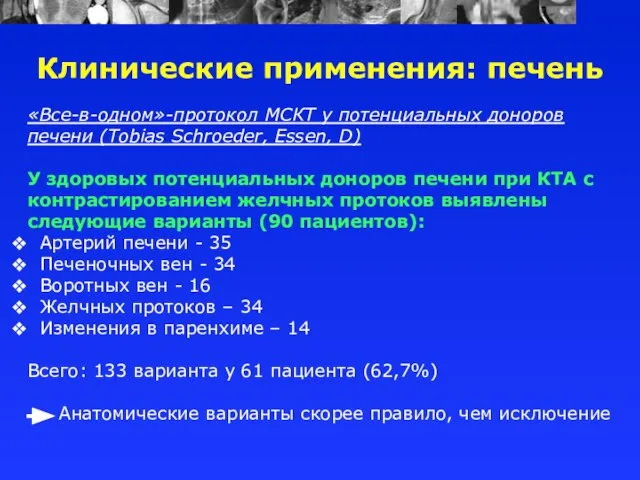 «Все-в-одном»-протокол МСКТ у потенциальных доноров печени (Tobias Schroeder, Essen, D) У здоровых