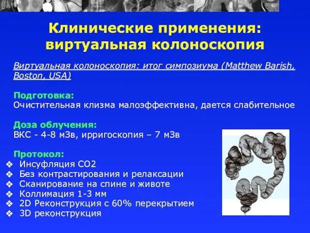 Виртуальная колоноскопия: итог симпозиума (Matthew Barish, Boston, USA) Подготовка: Очистительная клизма малоэффективна,