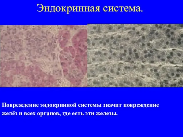 Эндокринная система. Повреждение эндокринной системы значит повреждение желёз и всех органов, где есть эти железы.