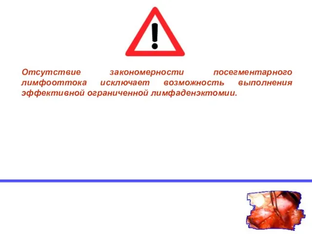 Отсутствие закономерности посегментарного лимфооттока исключает возможность выполнения эффективной ограниченной лимфаденэктомии.