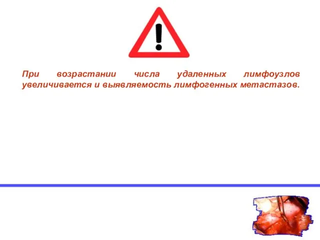 При возрастании числа удаленных лимфоузлов увеличивается и выявляемость лимфогенных метастазов.