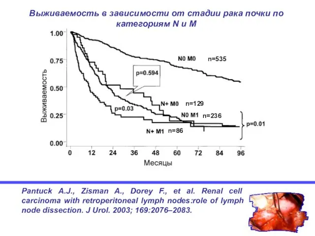 Pantuck A.J., Zisman A., Dorey F., et al. Renal cell carcinoma with