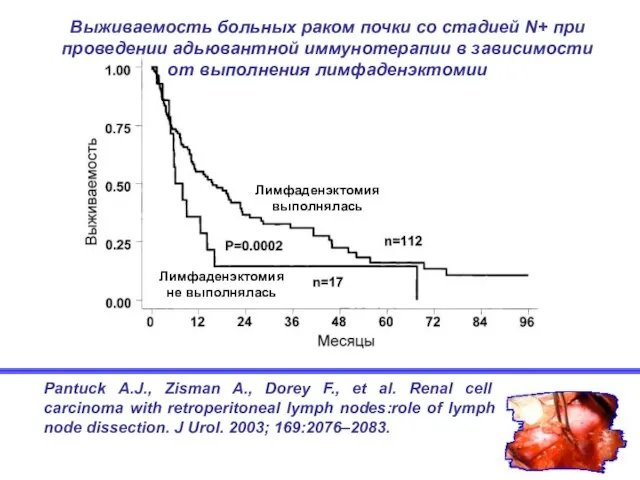 Pantuck A.J., Zisman A., Dorey F., et al. Renal cell carcinoma with