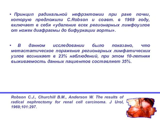 Принцип радикальной нефрэктомии при раке почки, которую предложили C.Robson и соавт. в