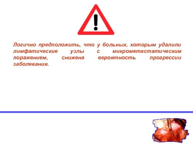 Логично предположить, что у больных, которым удалили лимфатические узлы с микрометастатическим поражением, снижена вероятность прогрессии заболевания.