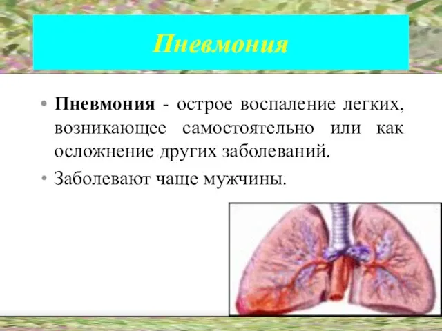 Пневмония Пневмония - острое воспаление легких, возникающее самостоятельно или как осложнение других заболеваний. Заболевают чаще мужчины.