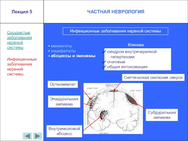 Сосудистые заболевания нервной системы Инфекционные заболевания нервной системы Инфекционные заболевания нервной системы