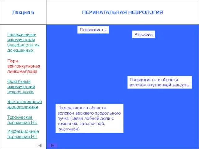 Гипоксически- ишемическая энцефалопатия доношенных Пери- вентрикулярная лейкомаляция Внутричерепные кровоизлияния Токсические поражения НС