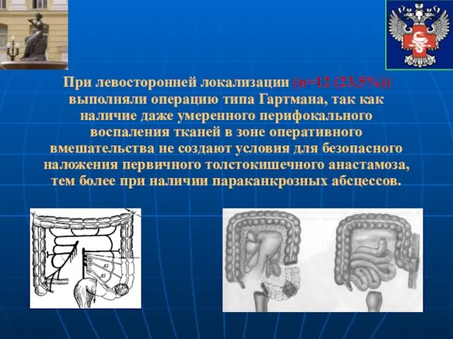 При левосторонней локализации (n=12 (23,5%)) выполняли операцию типа Гартмана, так как наличие