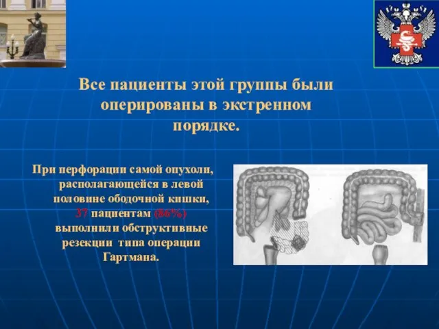 При перфорации самой опухоли, располагающейся в левой половине ободочной кишки, 37 пациентам